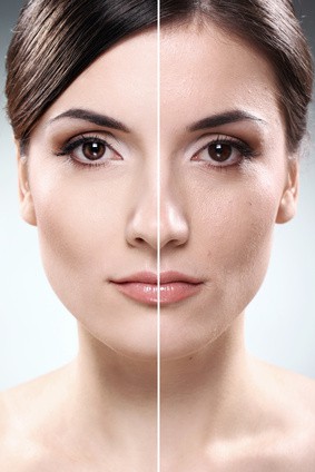 PRIMALUCE – chemický peeling