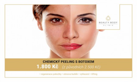 CHEMICKÝ PEELING S BOTOXEM